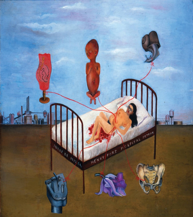 'Henry Ford Hospital' o 'La cama volando' (1932)